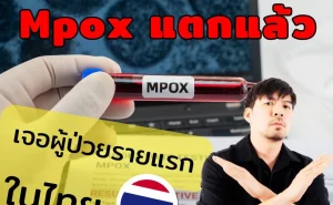 001 Mpox แตกแล้ว!