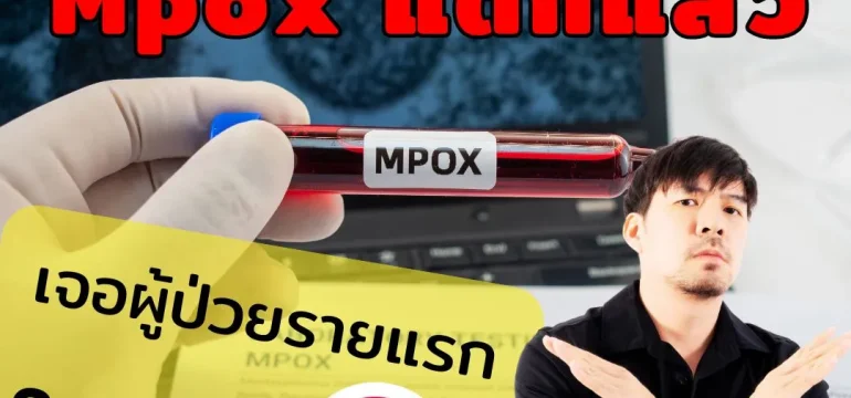 001 Mpox แตกแล้ว!
