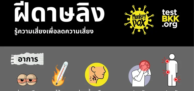 001 ฝีดาษลิง Monkeypox